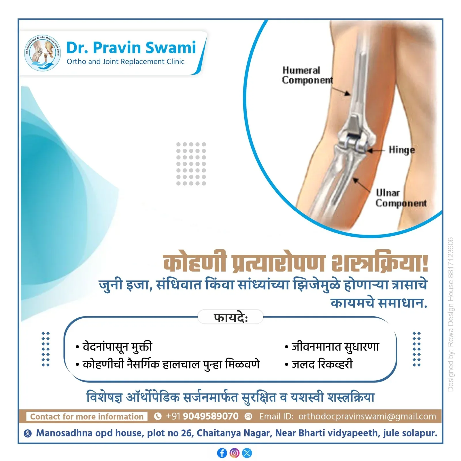 Elbow Replacement Surgery: Your Path to Pain‑Free Motion with Dr. Pravin Swami, Solapur